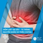 VIÊM LOÉT DẠ DÀY-TÁ TRÀNG: NGUYÊN NHÂN VÀ TRIỆU CHỨNG